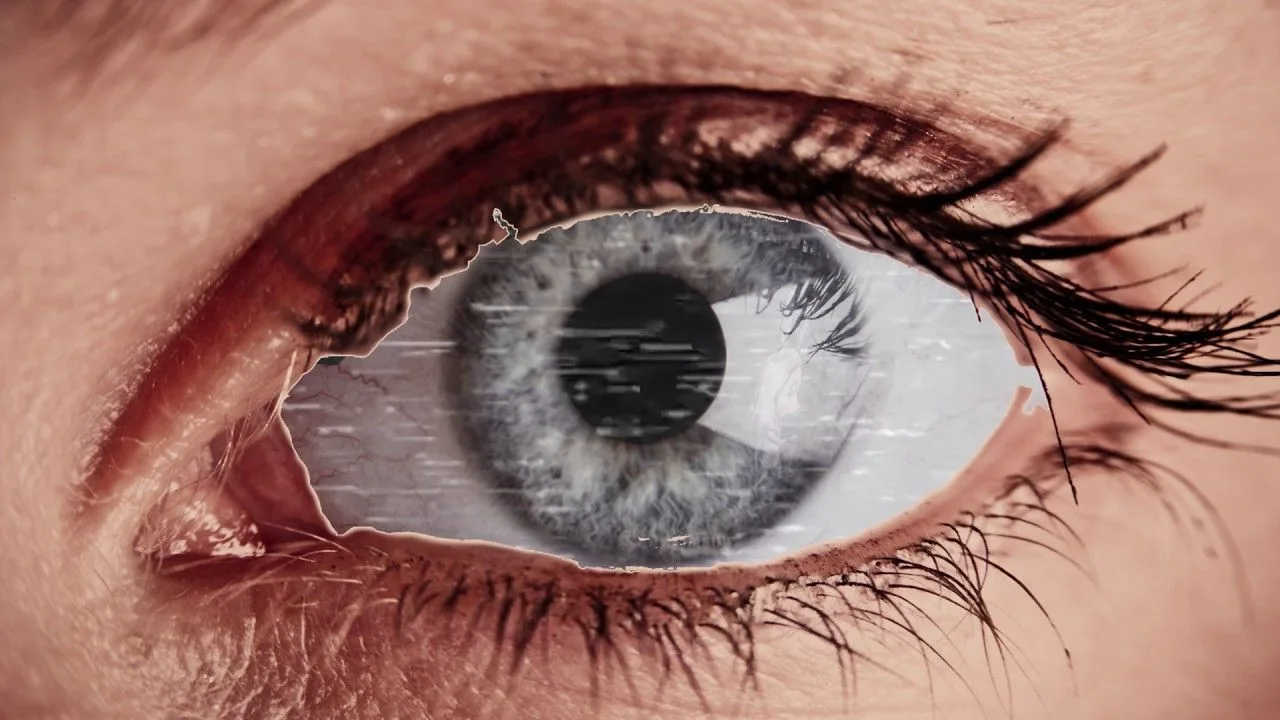 Eye angiography