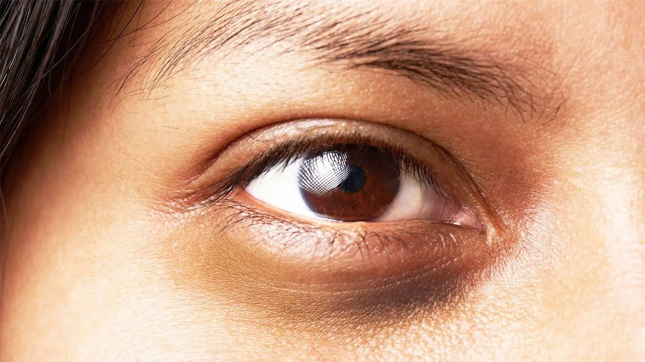 Eye angiography procedure