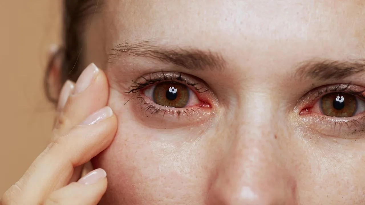 Eye hygiene
