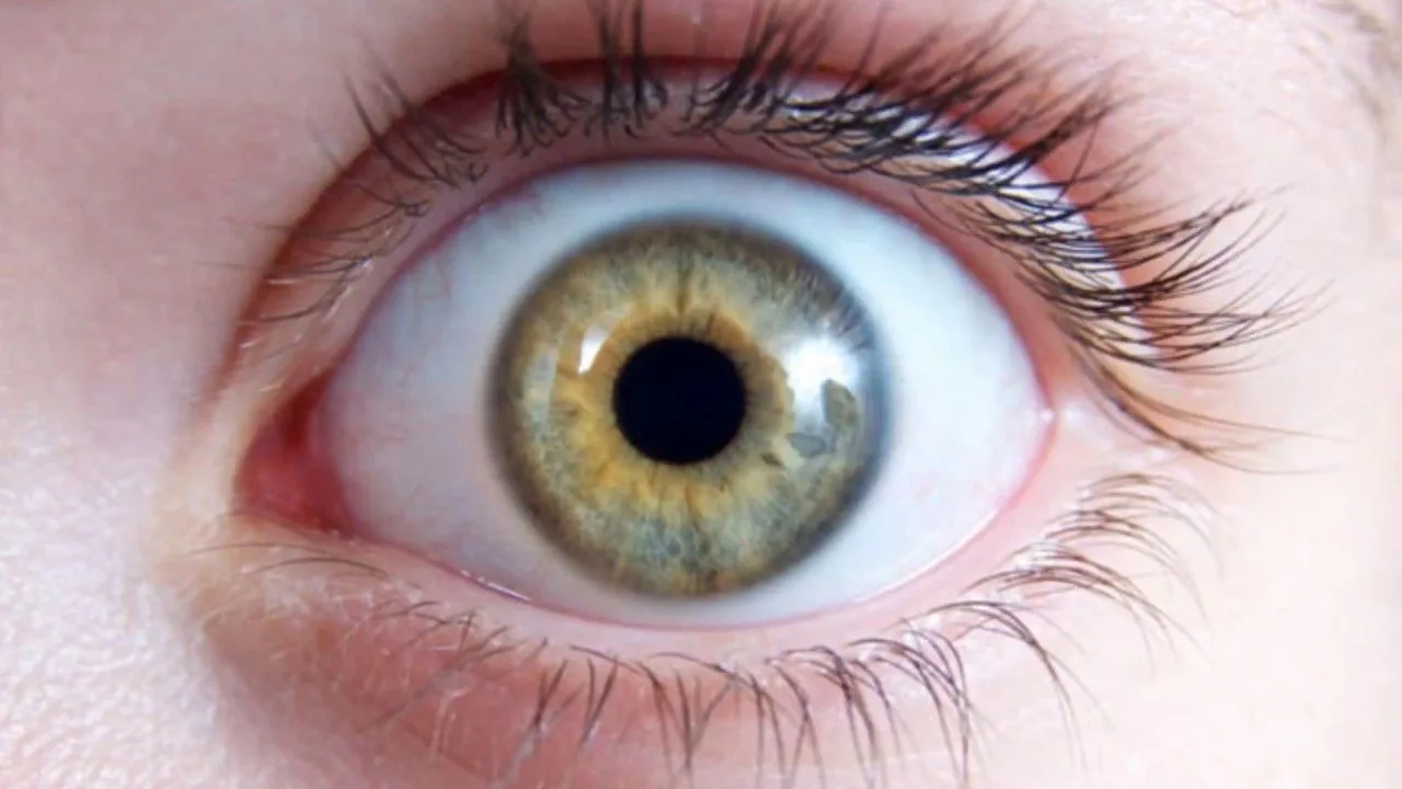 Was verursacht Lichtblitze im Auge?