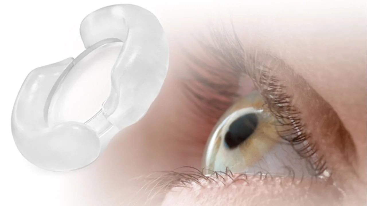 Implantable Collamer Lens Surgery