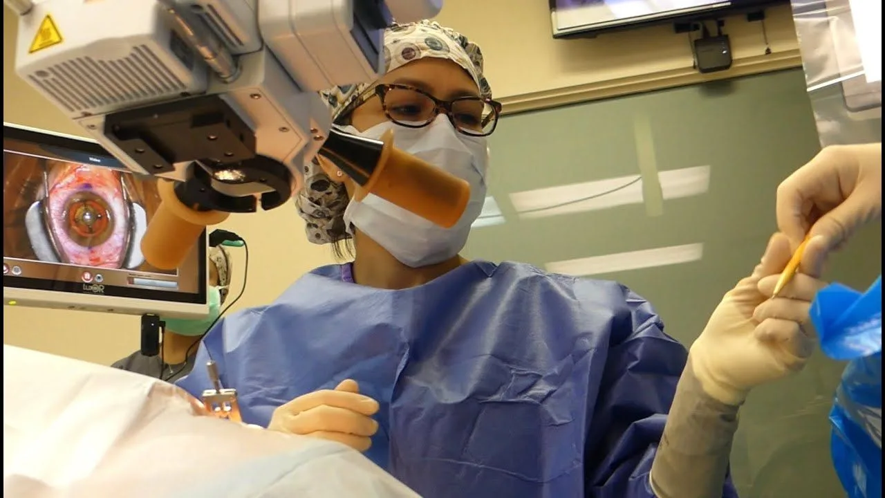 Cataract surgery