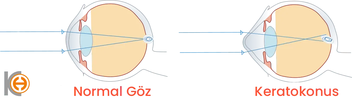 Crosslinking