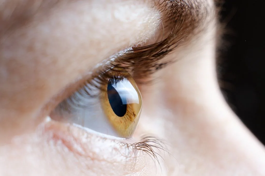 Keratoconus