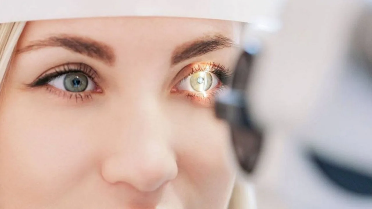 Poate operația laser să corecteze astigmatismul