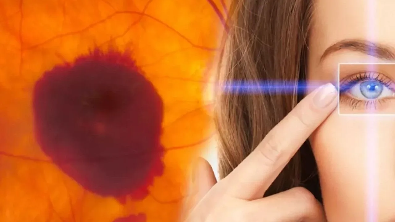 Macular test