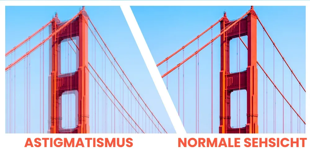 Astigmatism vs normal