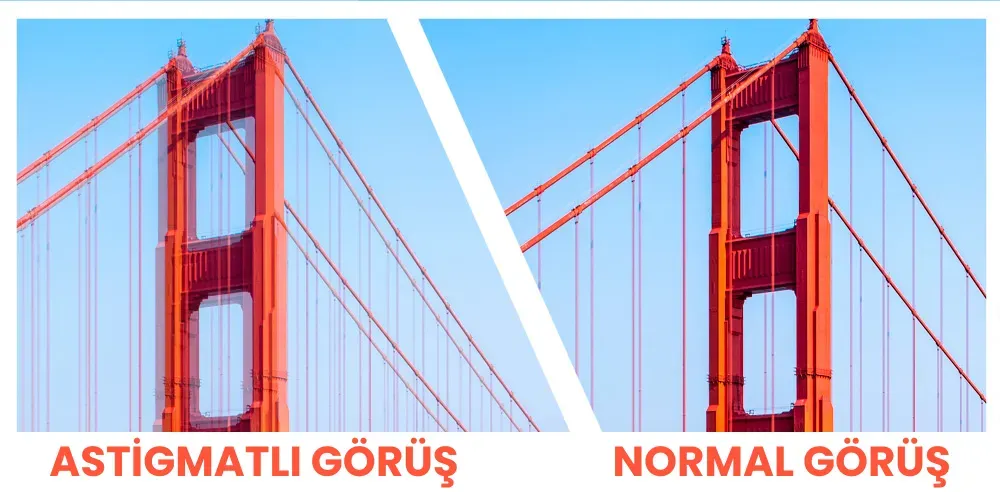 astigmatlı görüş ile normal görüş arasındaki fark nedir