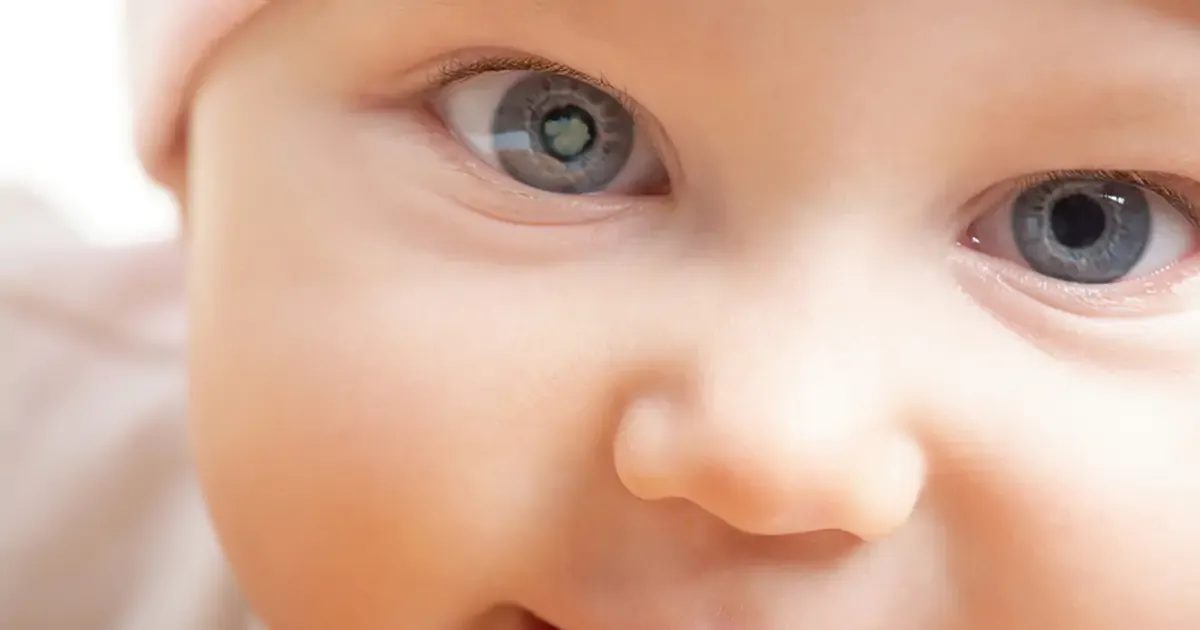 Cataract bij Kinderen en Baby's