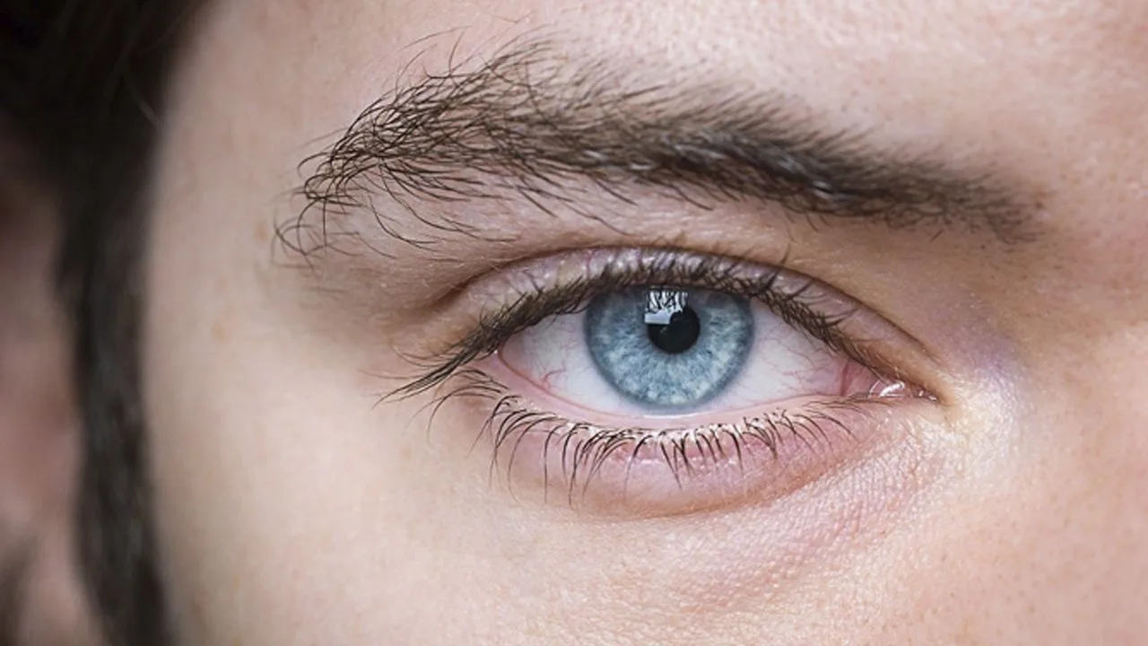 Moedervlek in het oog bij onderzoek