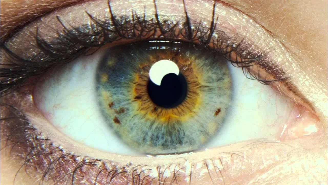 Moedervlek in het oog
