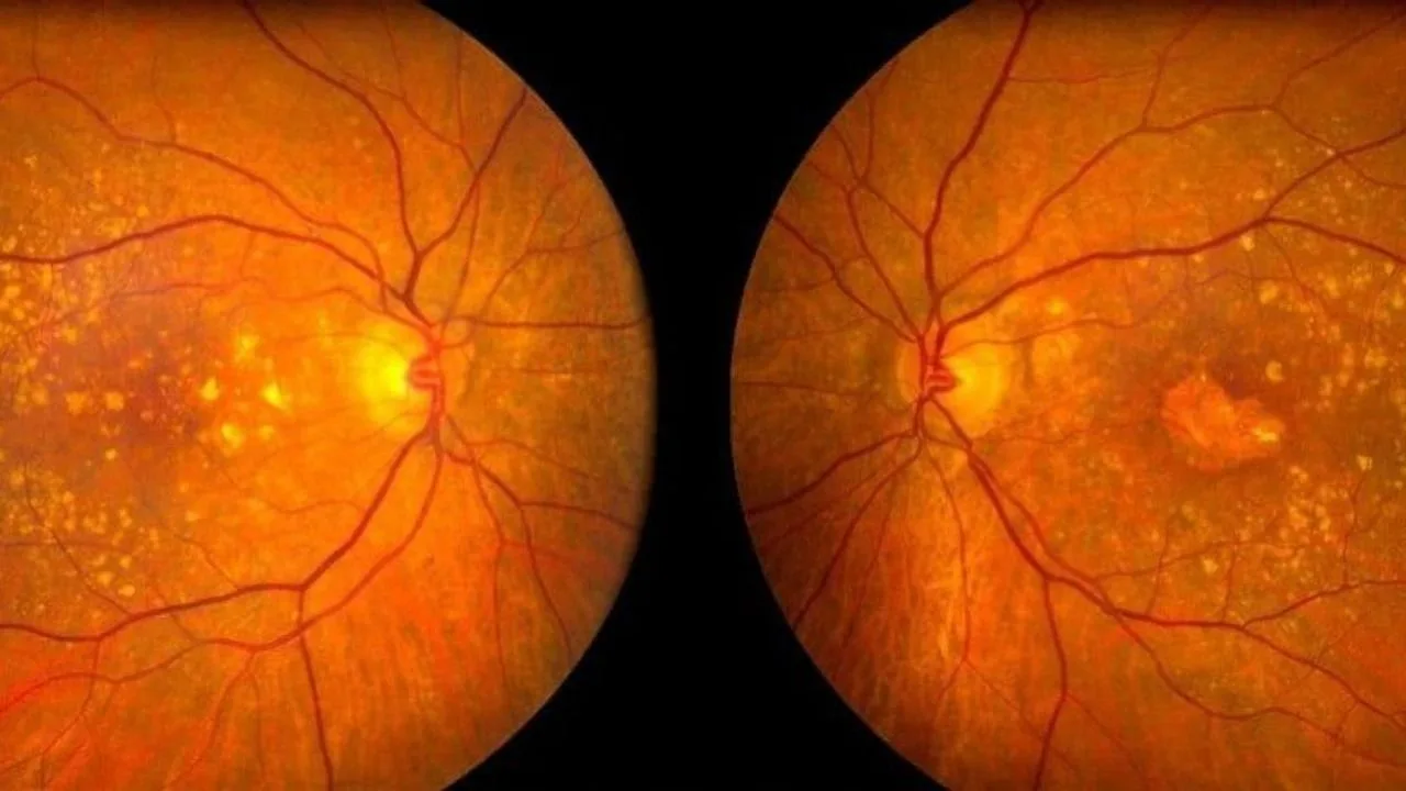 Wat is de macula?