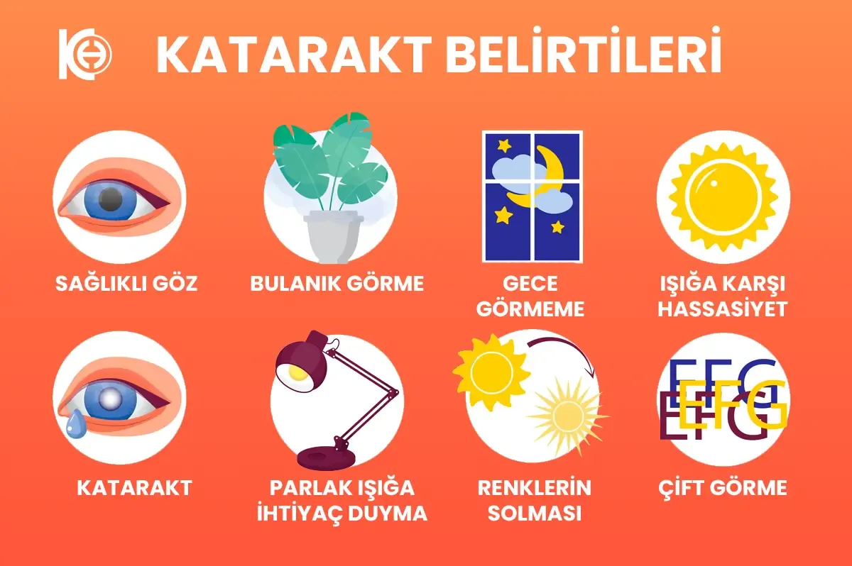 Katarakt Belirtileri
