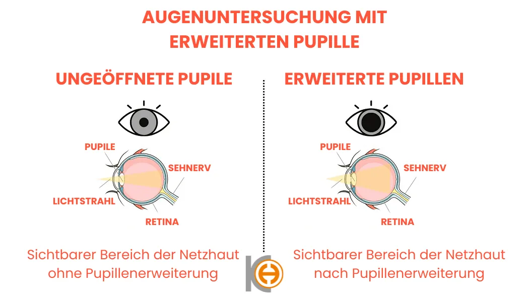 Pupil dilate