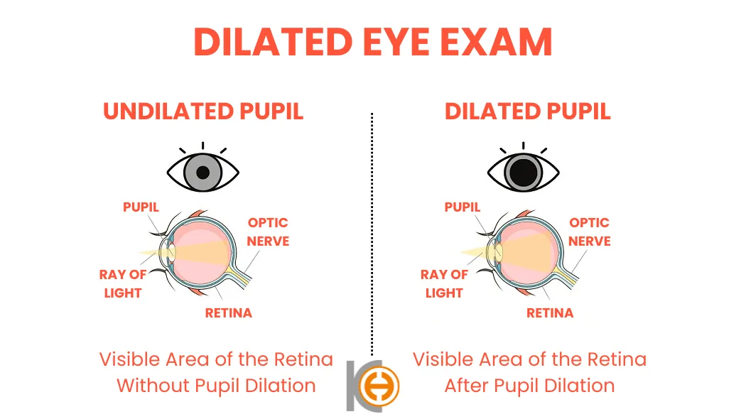 Verwijde pupil