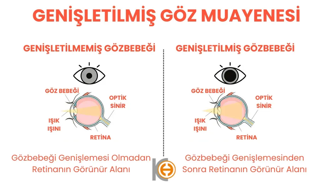 Pupil dilate