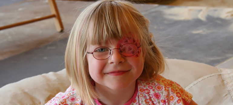 Amblyopia in Children and Infants