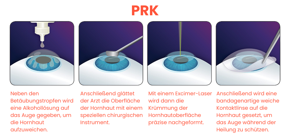 prk de