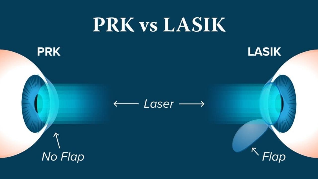 Best LASIK eye surgery in Istanbul