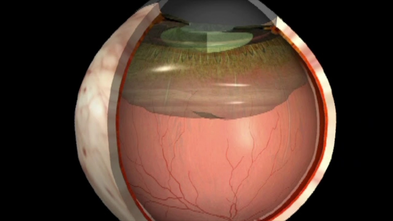 Vitreus Bozukluğu Nedir 1 Vitreus Bozukluğu