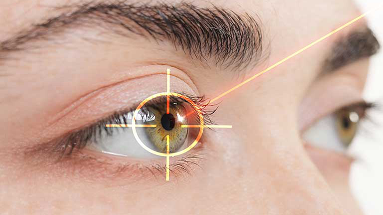 Yazın Göz Lazer Ameliyatı Olunur Mu? 3 Goz Lazer Ameliyati4