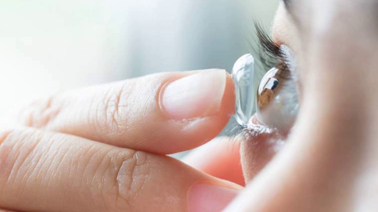 Kontakt Lens Nedir