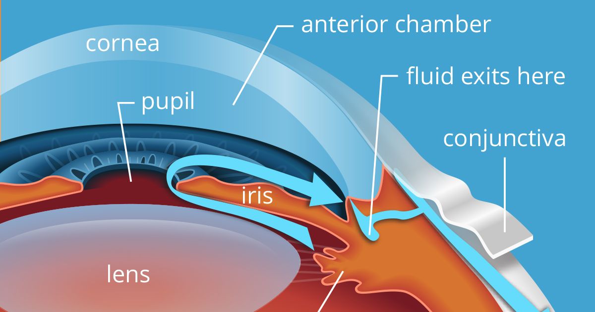 Lazer Ameliyatında Kornea Kalınlığı Neden Önemlidir? 2 kornea kalinligi