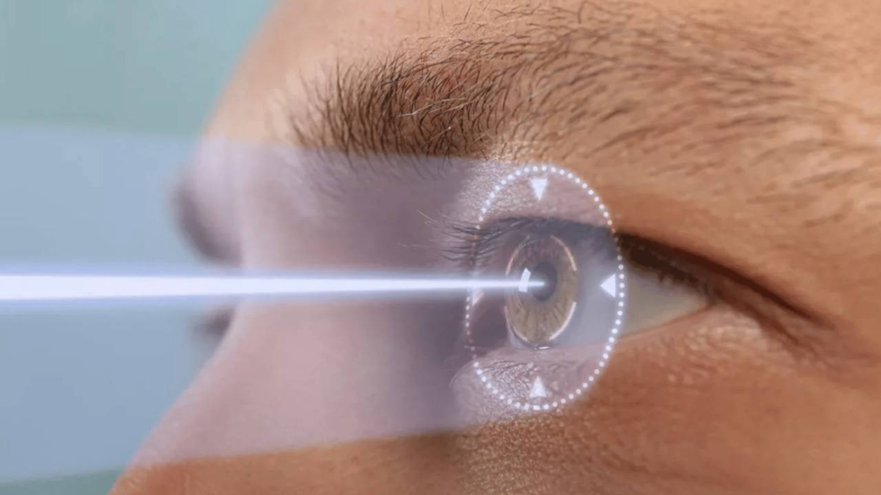 PRK Lazer Sonrası Bulanıklık